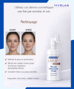Mousse nettoyante pre-peeling (étape 1) – Image 2