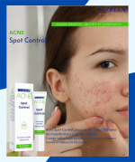Acné spot control – Image 2
